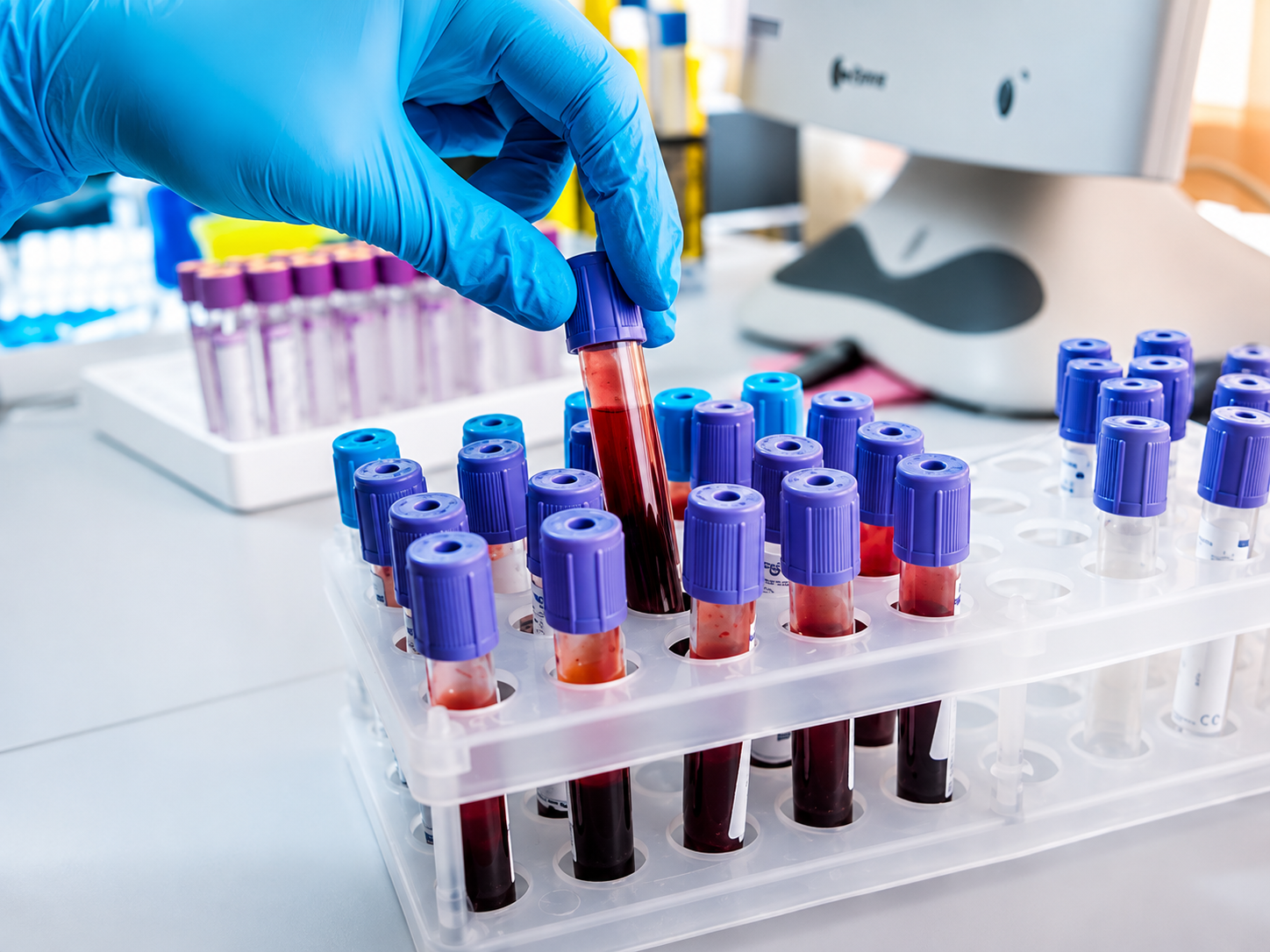 Comprehensive Hormonal Testing Services and Support