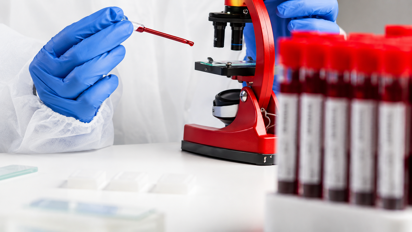 Advanced-Hormonal-Testing-at-Vishvas-Fertility-Centre