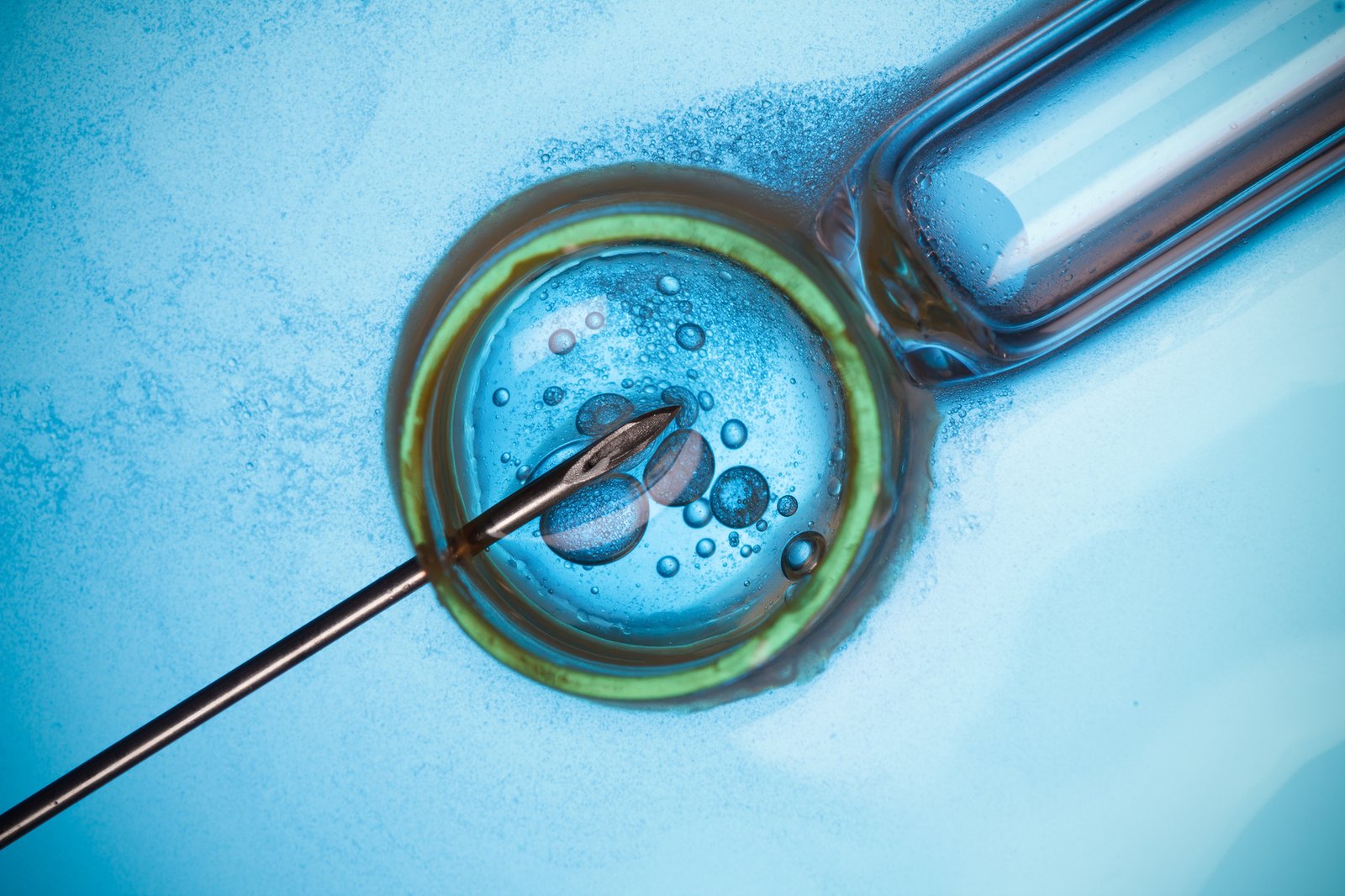 Advanced-IVF-Care-at Vishvas-Fertility-Centre